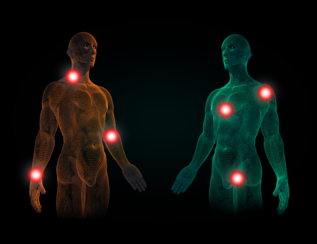 Image depicting common pain points on the body