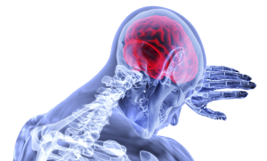 X-ray image of man with headache