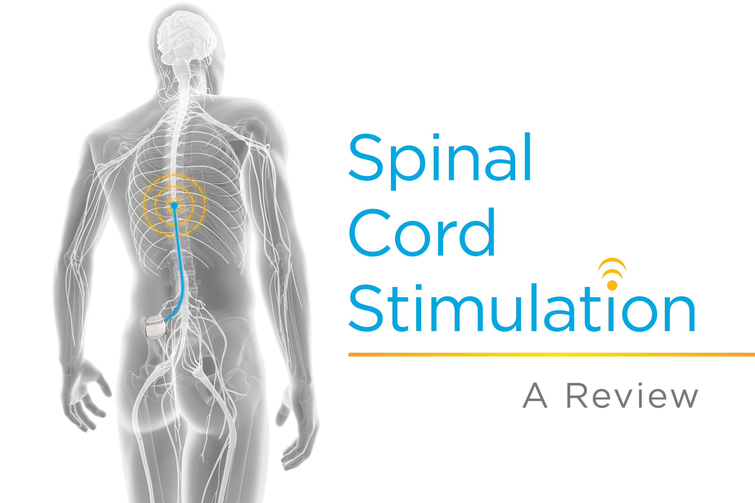 Spinal Cord Stimulation - Spine One
