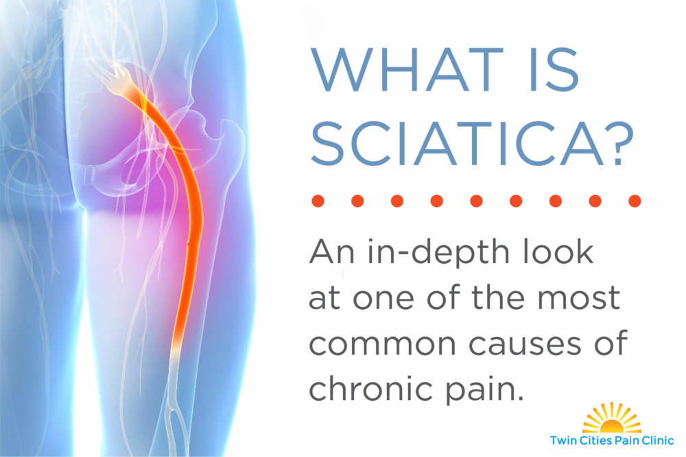 What is Sciatica? A brief guide - Sciatic Pain Relief Cushion