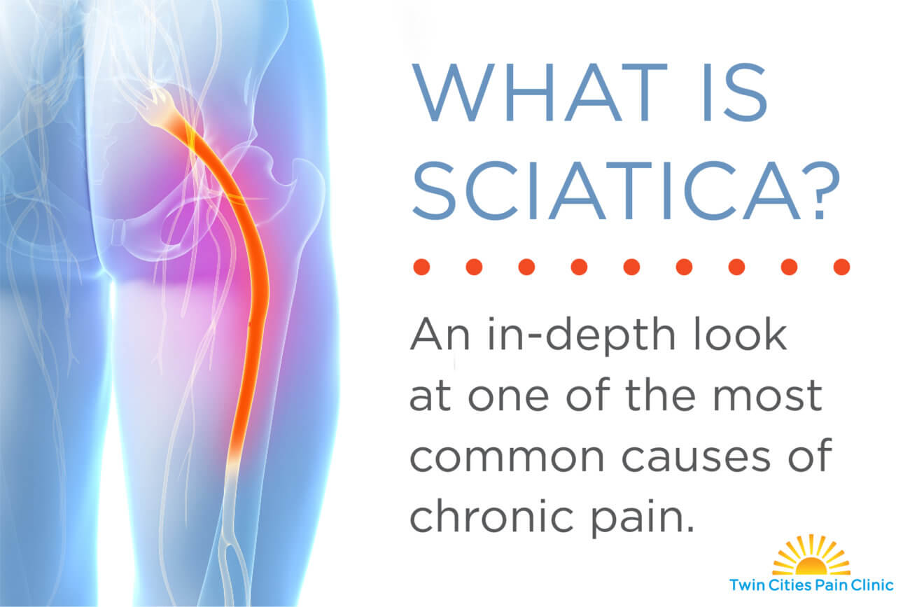 Sciatic Nerve Pain