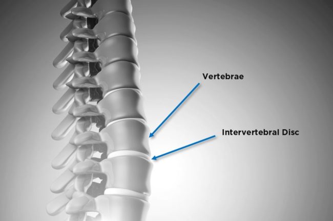 Image of spine segment demonstrating location of vertebral discs