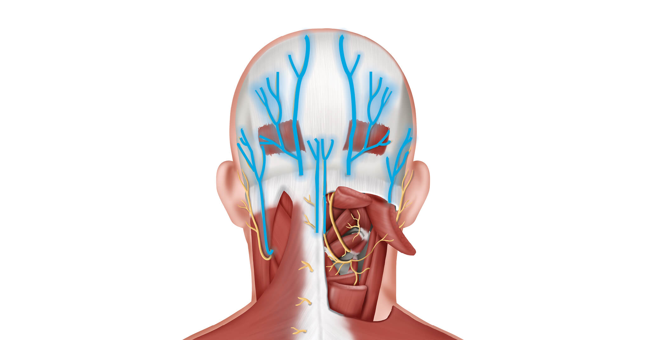 How Long Does Nerve Block Last For Occipital Neuralgia