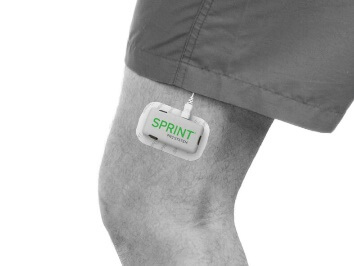 SPRINT® Peripheral Nerve Stimulation