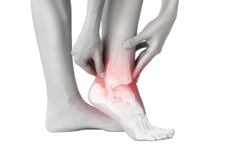 Close up black and white image of female holding ankle that is glowing red in pain_NO BACK