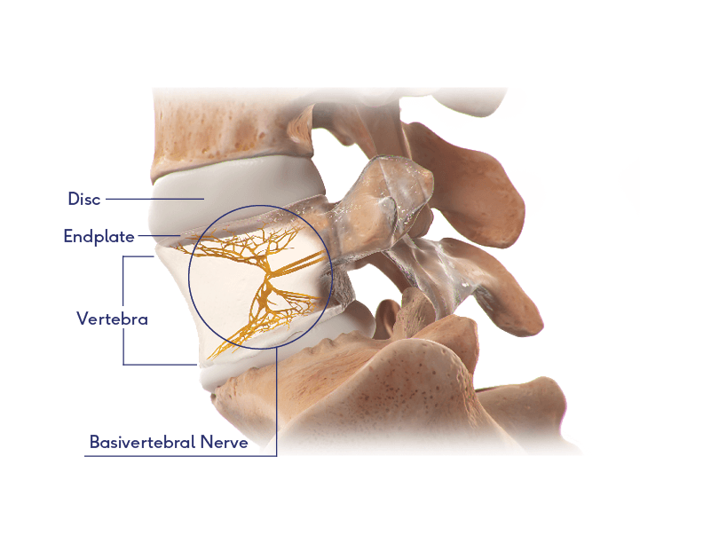 Illustrated, labeled diagram of the anatomy of a vertebrae bone
