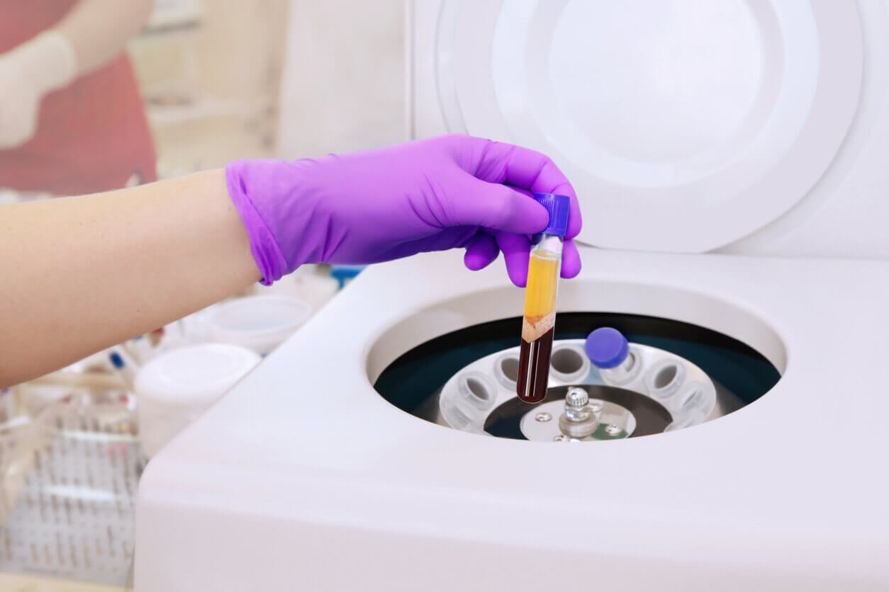 PRP for knee